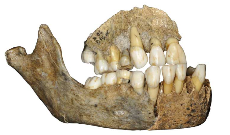一名生活在12万年前的尼安德特儿童的颚骨化石和牙齿化石.