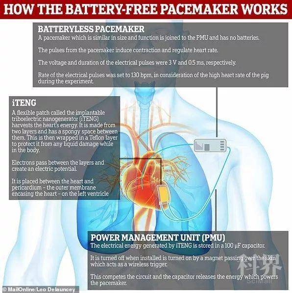 图2 共生心脏起搏器工作原理图(《每日邮报》)