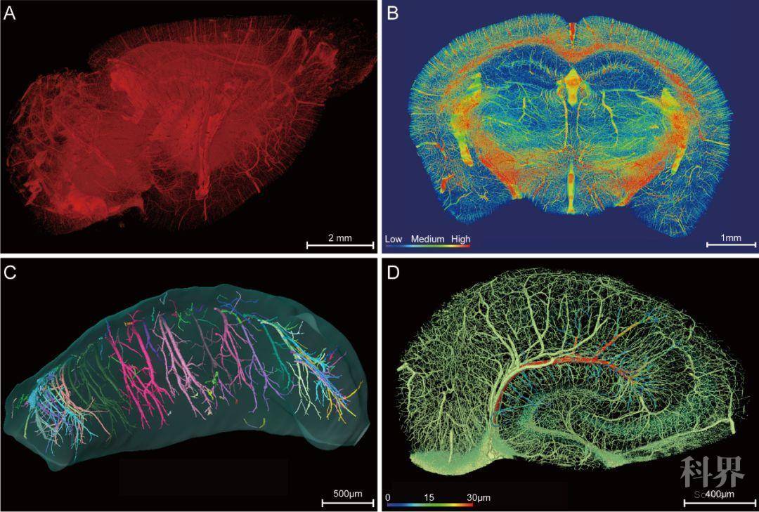 首个高精度小鼠全脑血管图谱揭示阿尔茨海默病脑的血管损伤