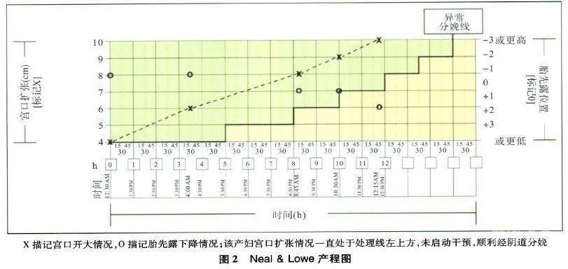 因此同张氏产程图一样只有处理线,但仅有宫口开大4cm入室(院)待产的