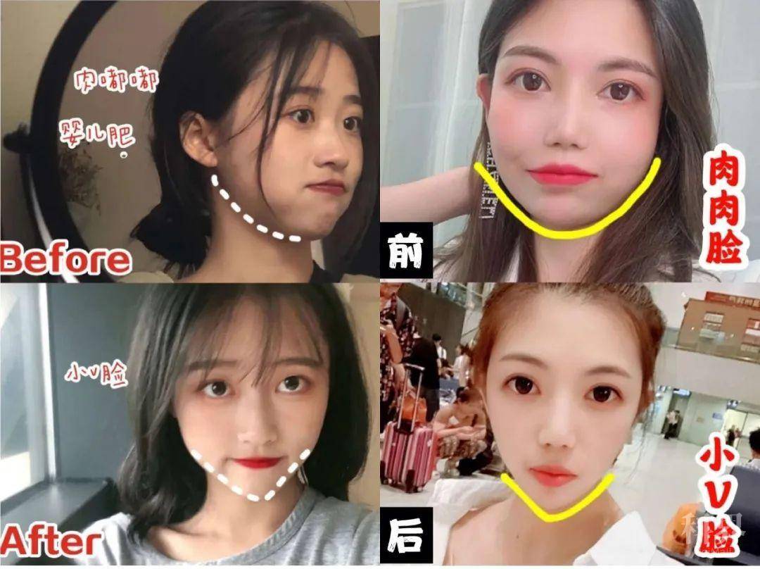 原来女人最怕的不是大粗腿,而是松弛下垂的大饼脸!