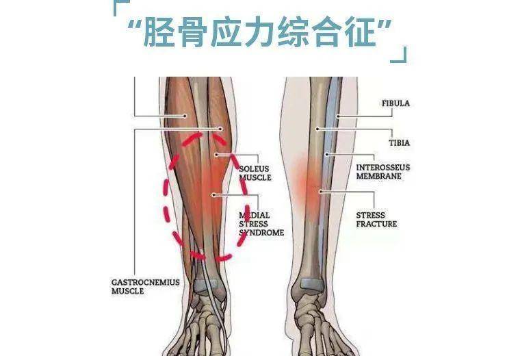小腿