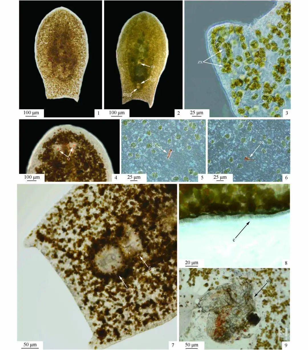 水产生物病害与防治"专栏—刺参养殖池塘中新敌害生物澳洲异尾涡虫的