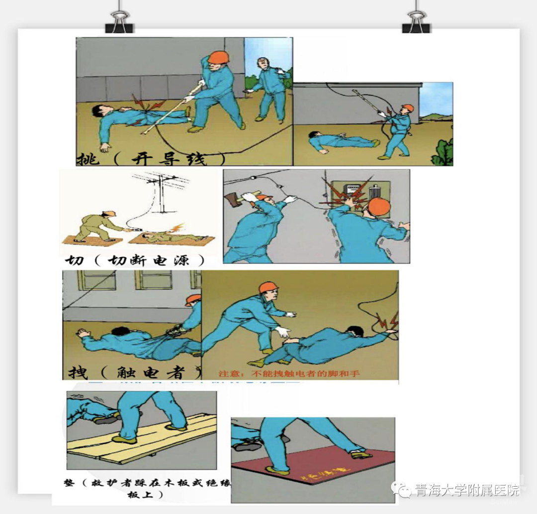 【科普】发生电击伤如何处理