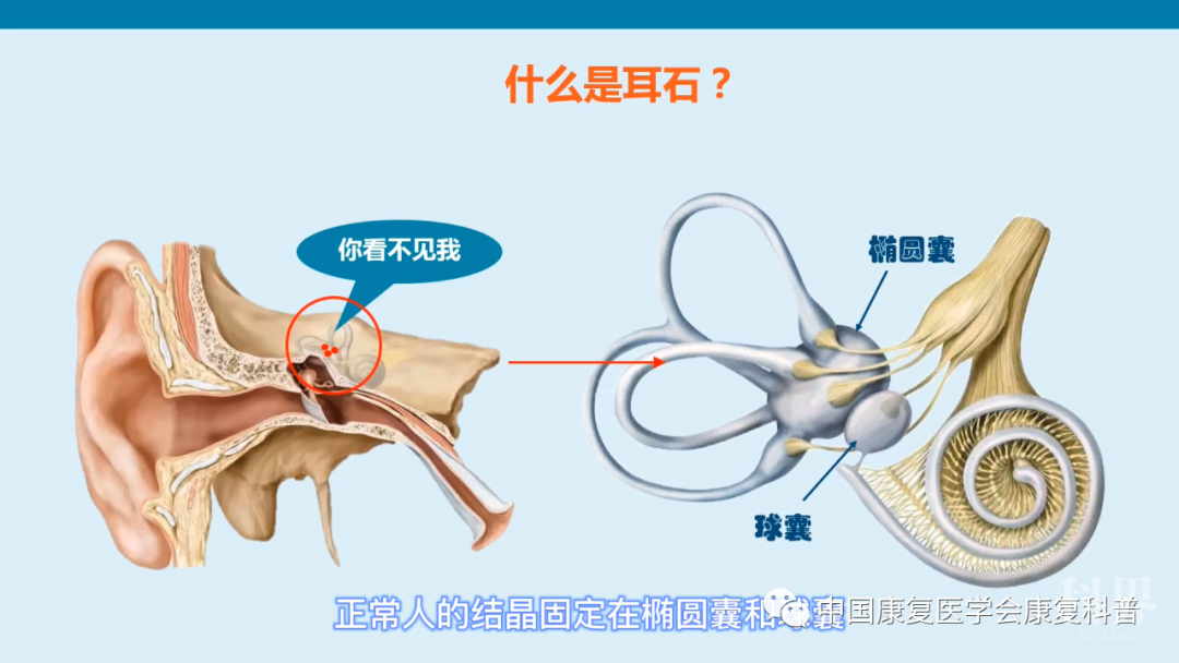 耳石症遇到康复,让您不再"石"来"晕"转