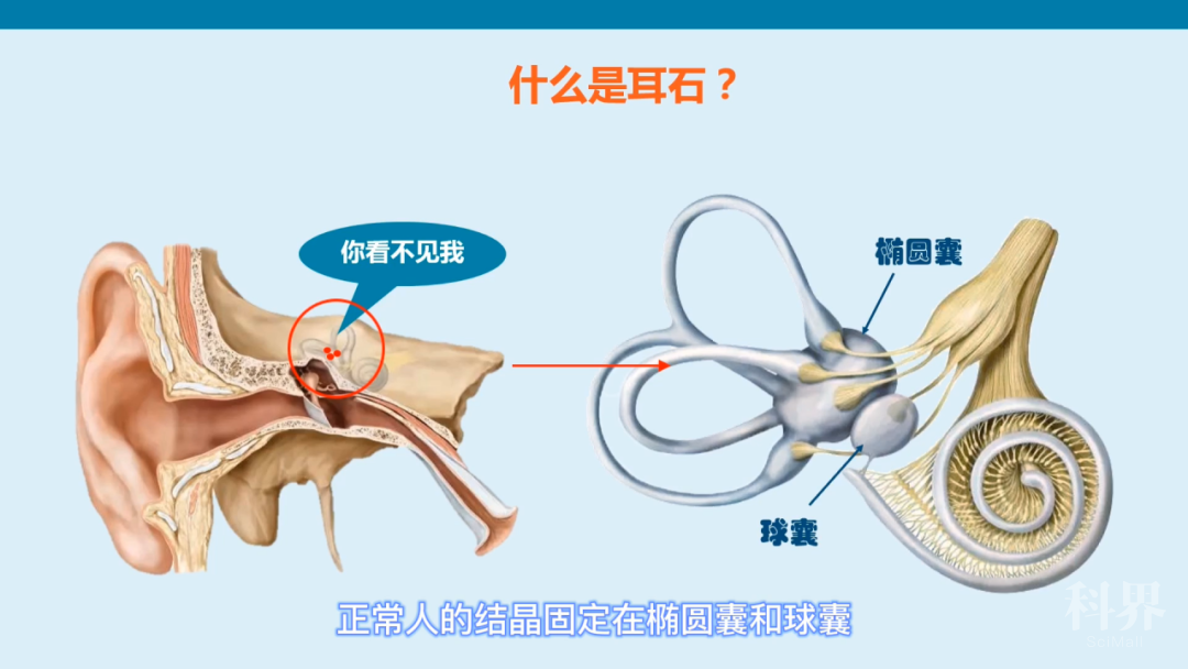 【科普工作委员会】 耳石症遇到康复,让您不再"石"来"