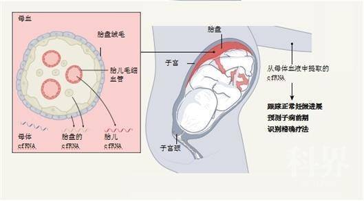  母体血液中游离RNA的应用。  图片来源：Andrea Edlow/《自然》