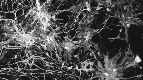 在实验室培养皿中培育这些大脑皮层神经元的技术使得追踪更多与大脑扩张有关的基因成为可能。.jpg