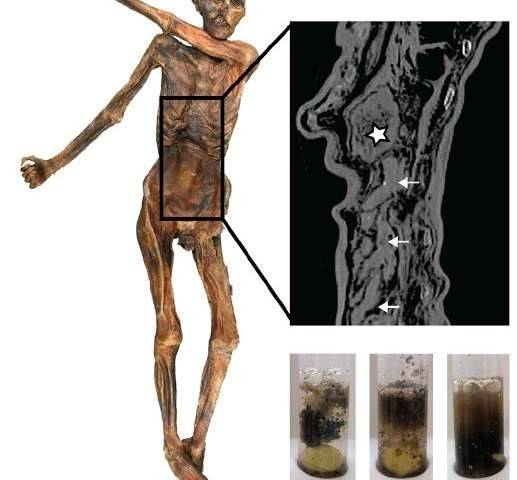 x.jpg