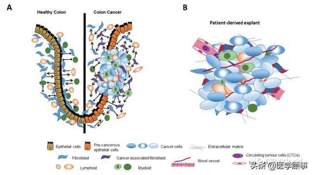 结直肠癌微环境T细胞代谢.jpg
