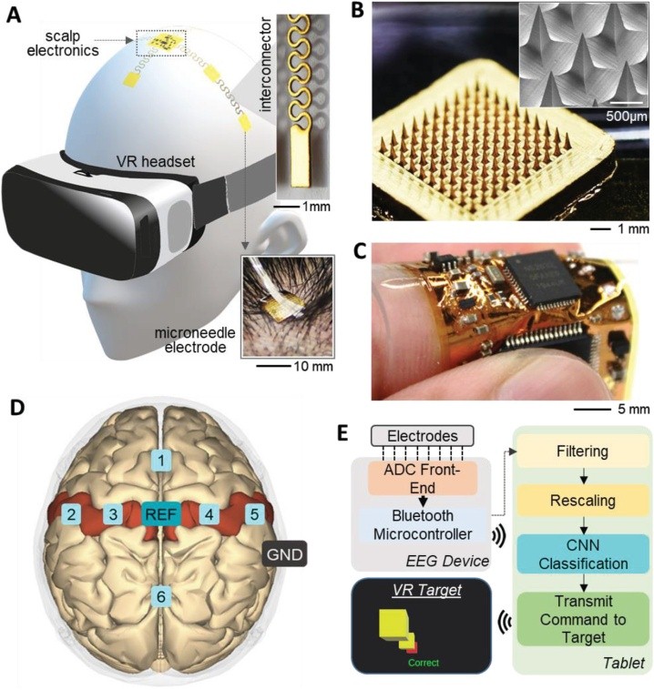 Synchron脑机接口图片