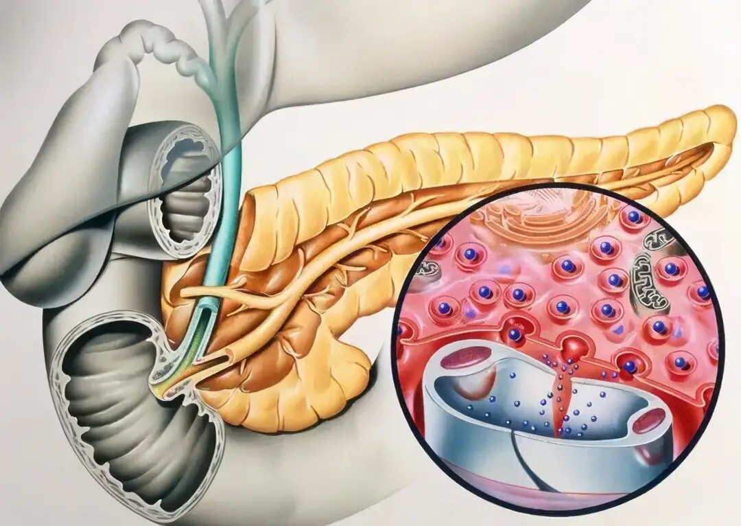胰腺“类器官”.jpg