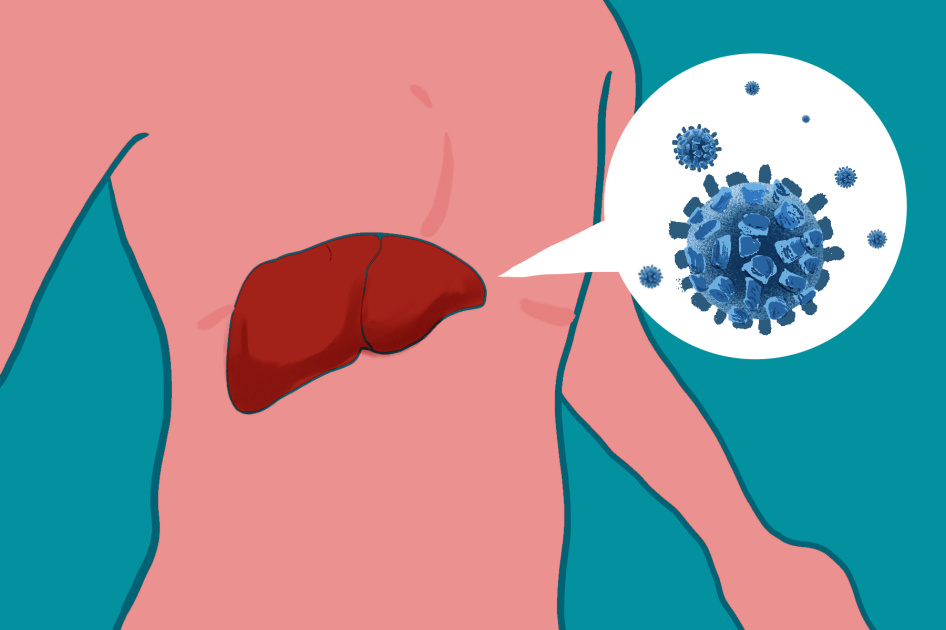 不明原因肝炎与普通肝炎有哪些区别,急性肝炎