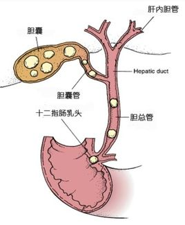 宽约3～5cm,壁厚1~2mm,分为底,体,颈,管四个部分,通过胆囊管和胆总管