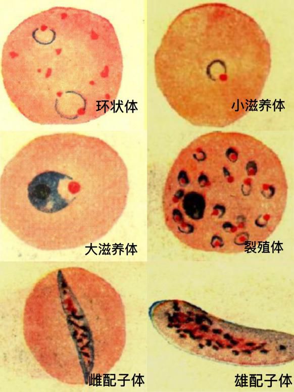 疟原虫的种类图片