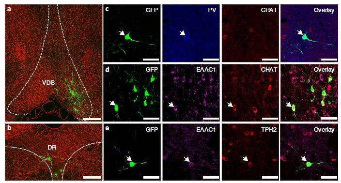 多种神经递质调节mpfc中的gaba能神经元使用荧光微光学切片断层扫描