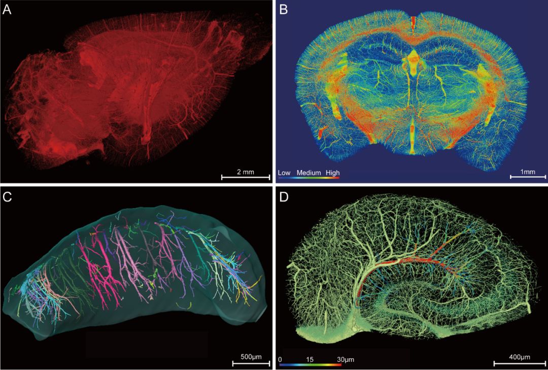 nsr:小鼠全脑血管图谱揭示阿尔茨海默病脑的血管损伤