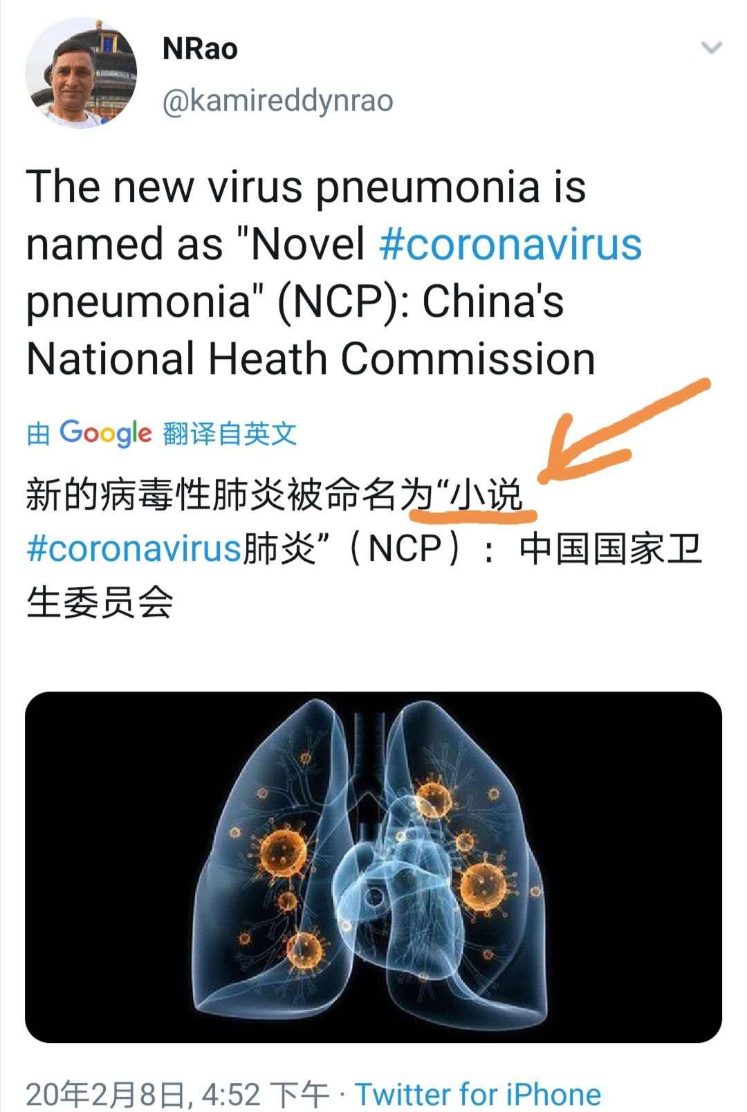 可惡的新冠病毒有英文名字了:ncp