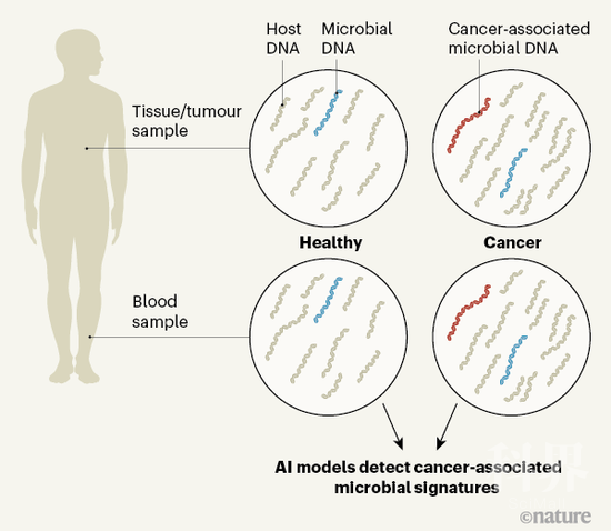 ▲在各种组织和肿瘤中都可以发现微生物的核酸片段，利用人工智能对血液中核酸片段的特征进行识别（参考资料[2]）
