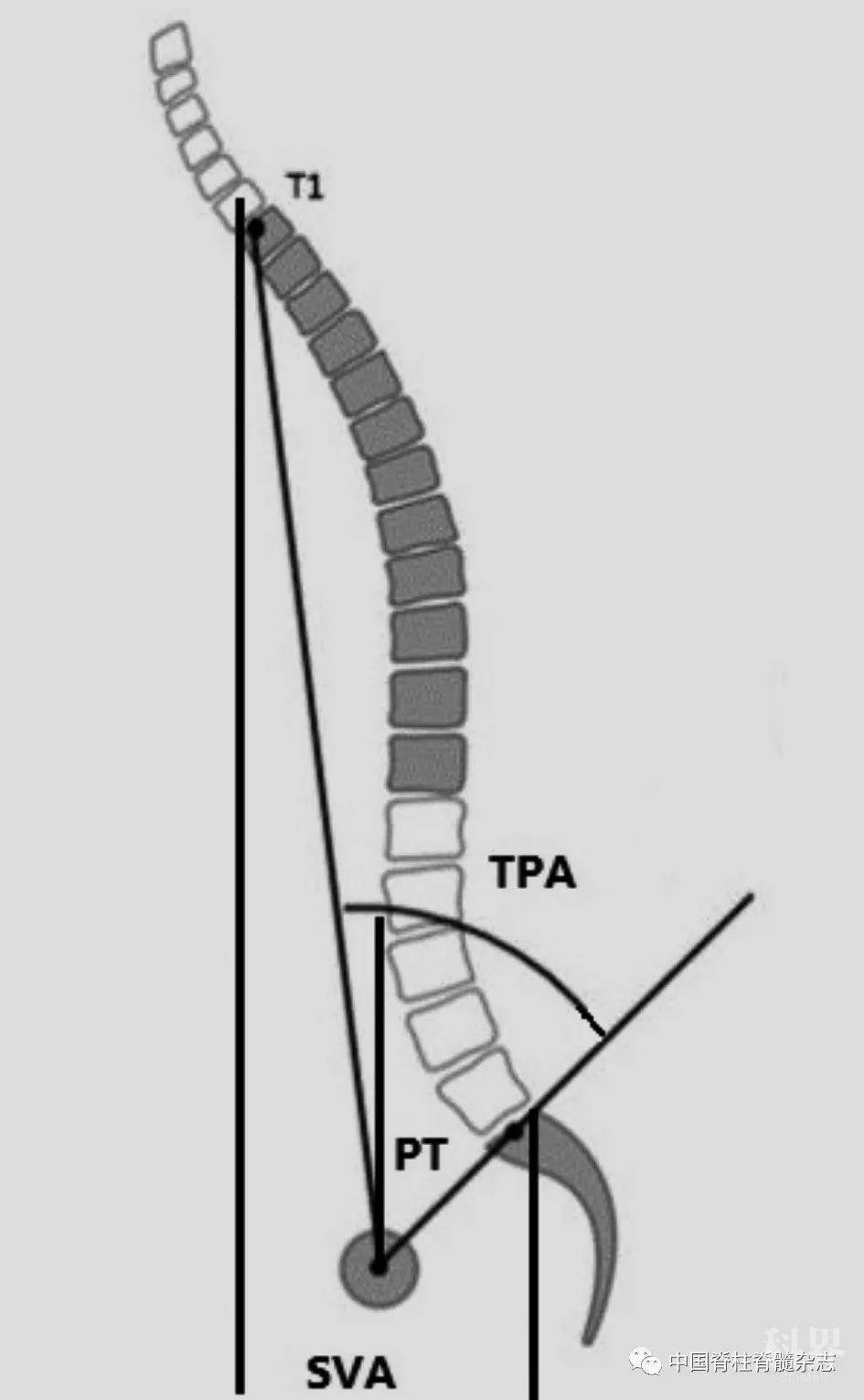 中老年人从站立位到坐位的脊柱矢状位序列变化(临床论著)
