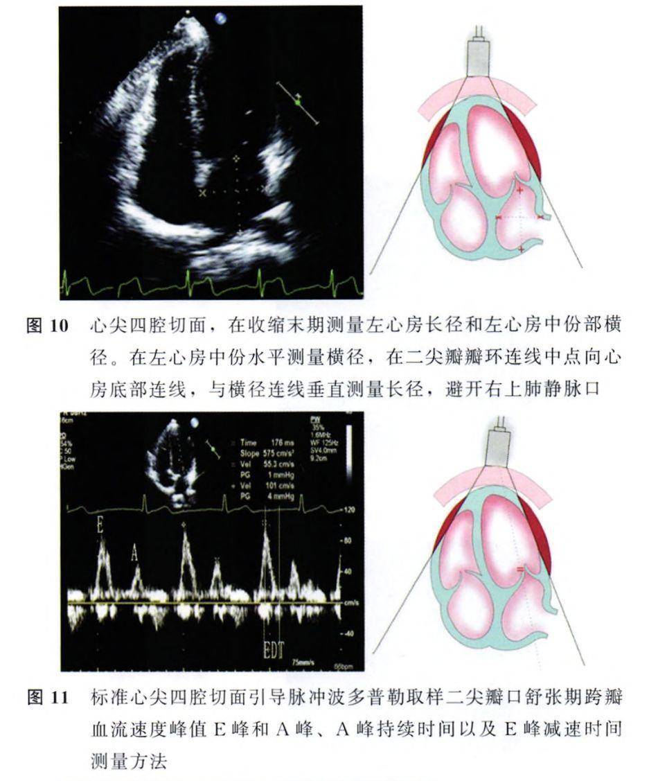 指南 成年人超声心动图检查测量指南学术资讯 科技工作者之家