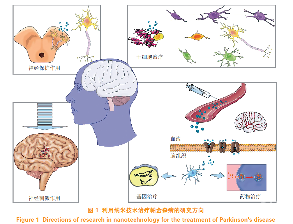 纳米技术应用于帕金森病治疗的研究进展