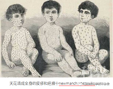 防疫 天花病毒的前世今生学术资讯 科界