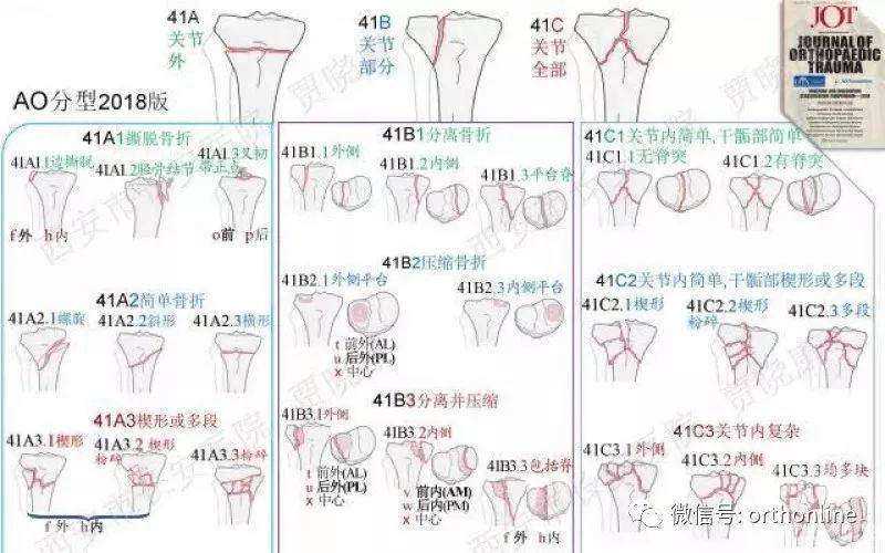 一文掌握胫骨平台骨折临床诊疗要点学术资讯 科界