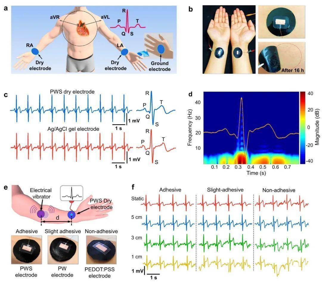 可拉伸自粘附纯有机干电极用于长期稳定检测人体表皮生物电信号