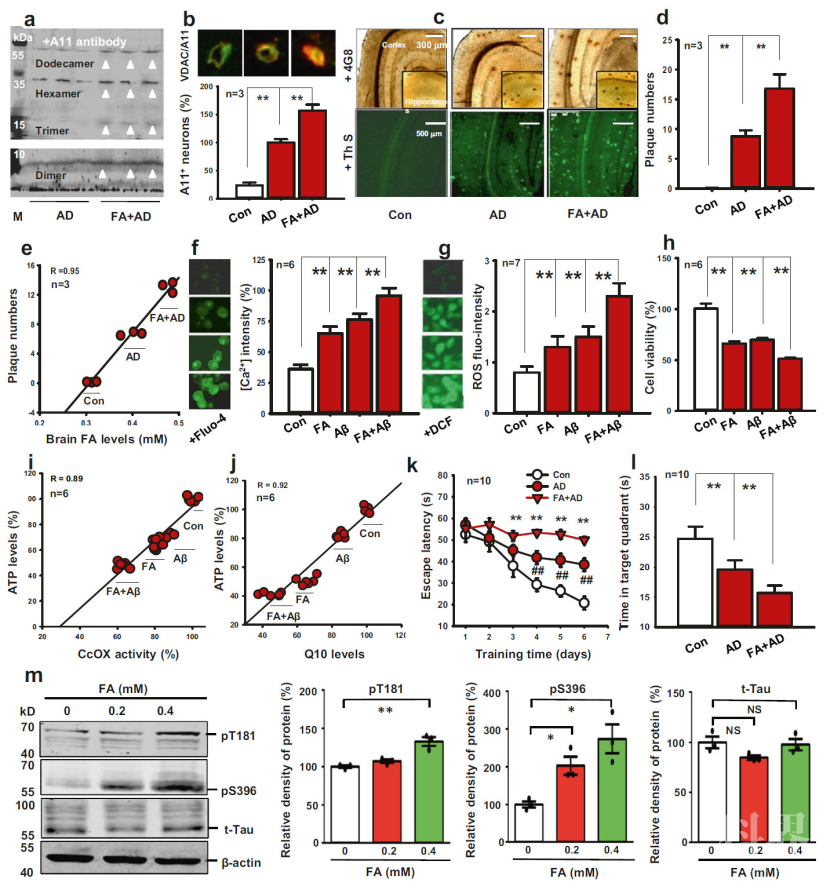 brain阿尔兹海默症海马ca1区的突触组织的三维分析