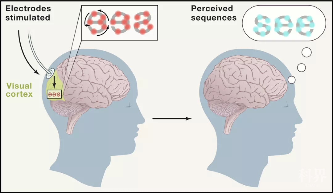 science大腦植入物繞過眼睛可使盲人重見光明人類治癒失明僅一步之遙