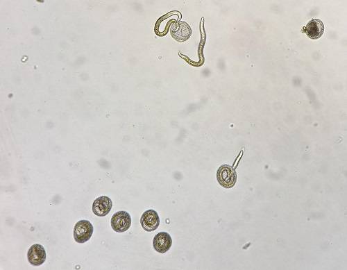 柳叶刀子刊:发现白瞳症眼弓蛔虫病全球新病例 学术资讯 - 科技工作者